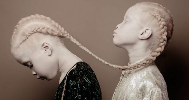 Ты их не забудешь! 11-летние сестрички-альбиносы покорили мир необычайной красотой…