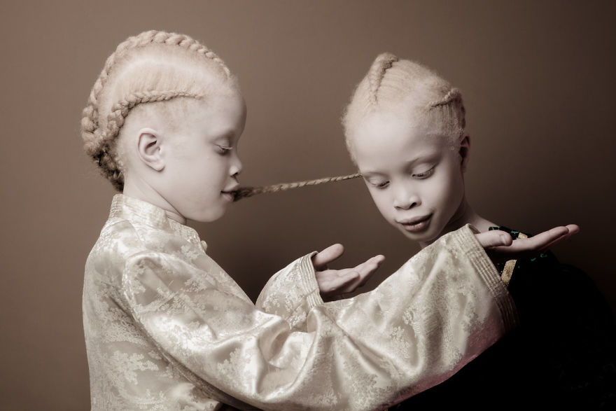albino-twins-models-1-58e74afbccf94__880