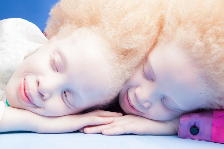 albino-twins-models-2-58e74afe0115f__880