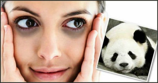Устраняем эффект панды!) 5 самых простых способов избавиться от темных кругов под глазами