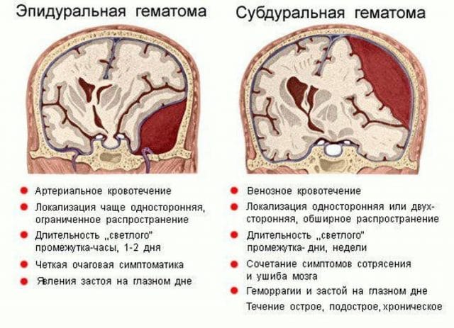 Удар головой об стол