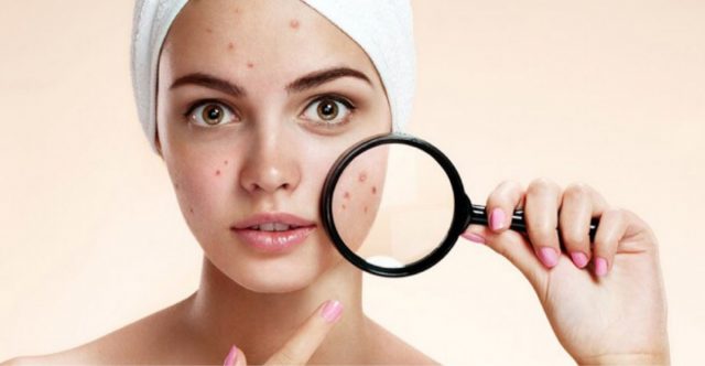 О чем говорит ваша кожа: проблемы пищеварения и высыпания на коже