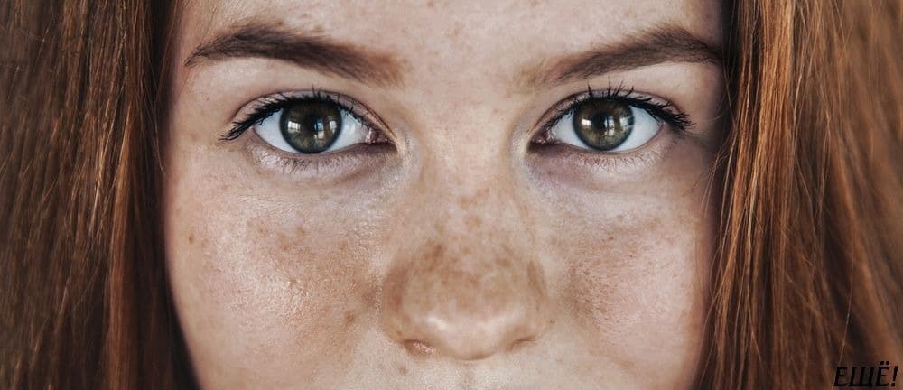 пигментация на коже лица