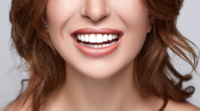Эффективные способы отбеливания зубов