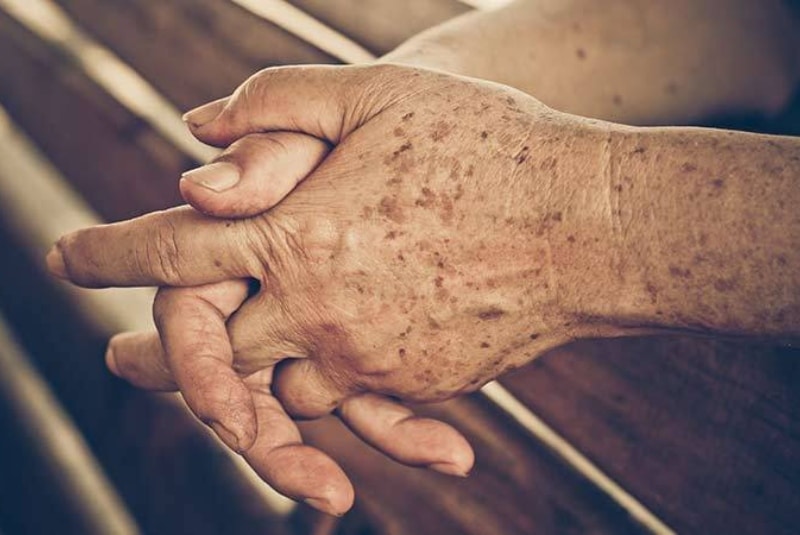 Что делает ваши руки старыми? Узнайте, как избавиться от самых частых проблем с кожей рук рис 2