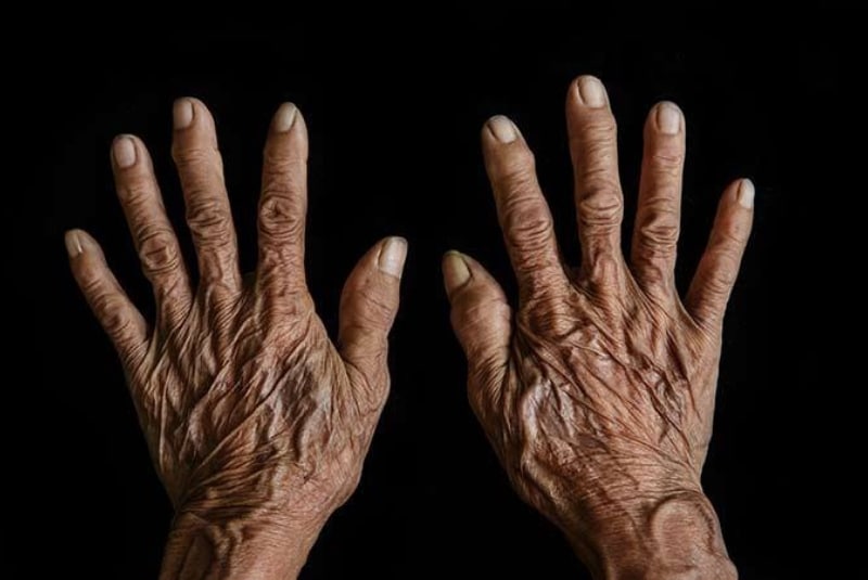 Что делает ваши руки старыми? Узнайте, как избавиться от самых частых проблем с кожей рук рис 4