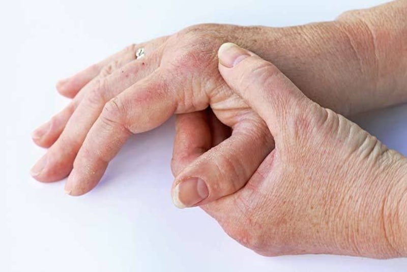 Что делает ваши руки старыми? Узнайте, как избавиться от самых частых проблем с кожей рук рис 5