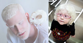 beautiful-albino-people-albinism-12-582ebf0687ed7__880