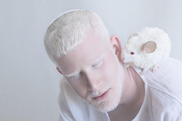 Парень альбинос