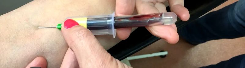 забор крови у донора шприцом из вены