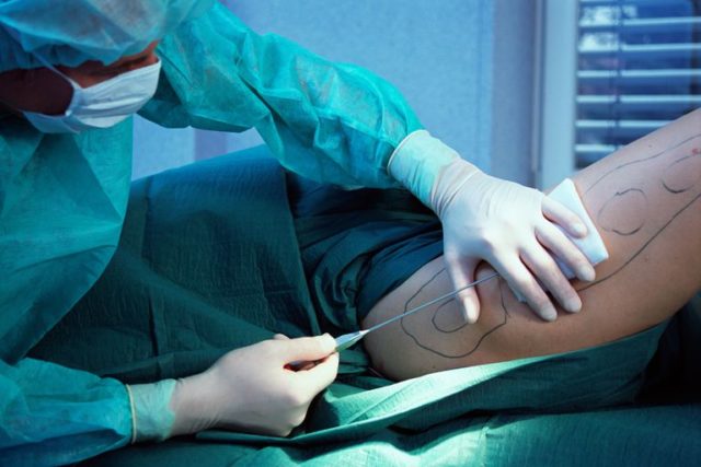 хирург делает процедуру девушке на ноге