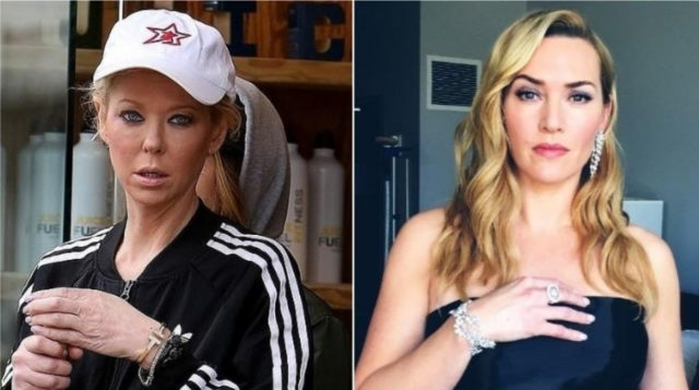 Пластика vs гены: 6 звёздных пар, которые являются ровесницами