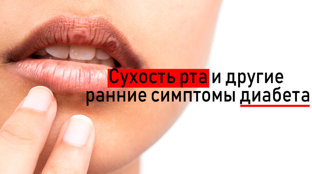 dry-mouth-syndrome-min