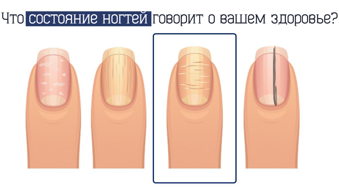 fingernails-5
