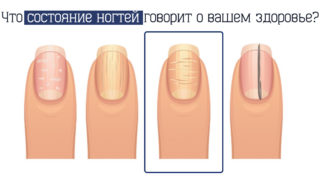 fingernails-5