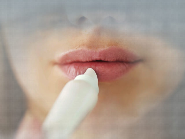 лечение простуды на губах