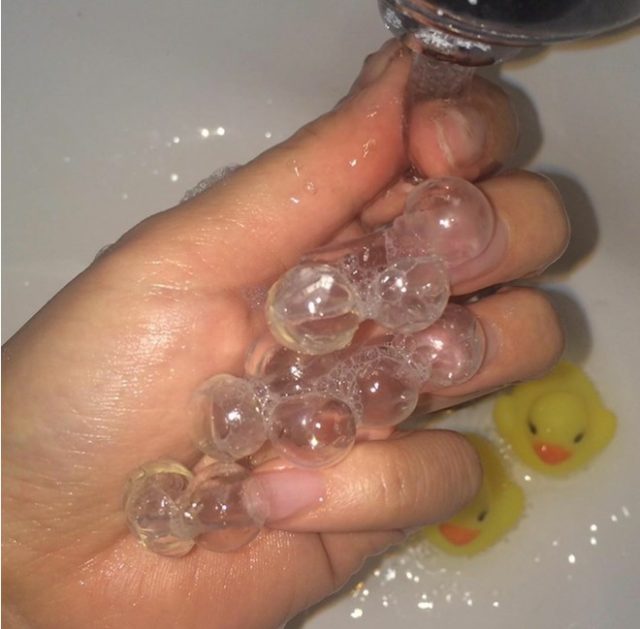 женская рука с пузырями на ногтях