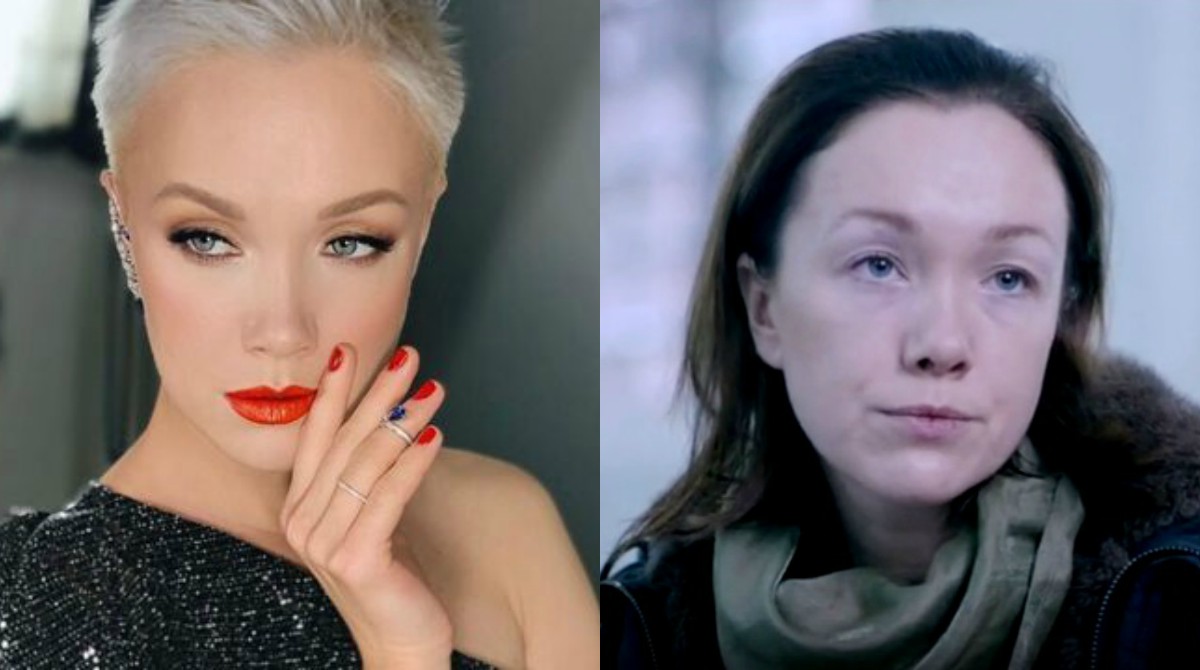 Дарья мороз до и после пластики лица фото