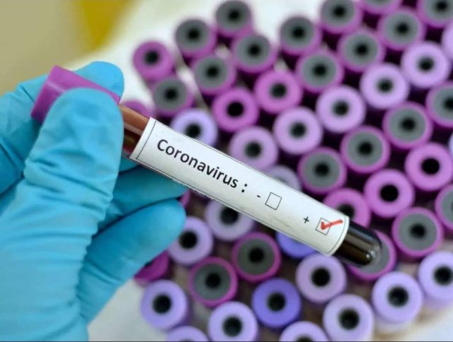 пробирка с коронавирусом