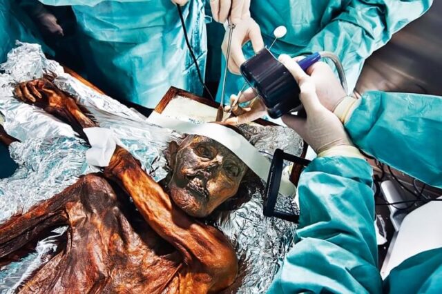 мумия человека на столе хирургов